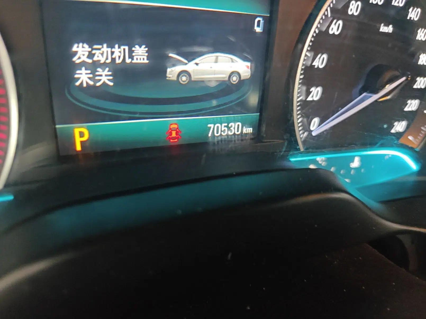 Buick GT 2017 15N Automatic Elite Version — миниатюра 11